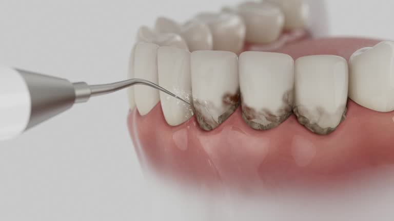 Trusted Tooth Extraction service in Jonesboro, AR - Dentist Open Now